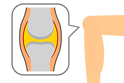 膝軟骨がすり減るメカニズムといますぐ始めたい2つの対策法
