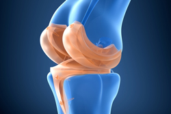 膝の痛みを引き起こす「半月板損傷」の原因や症状とは