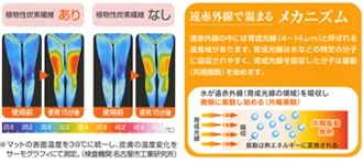 温蒸浴うるおい｜フランス総合医療株式会社